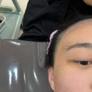 동부공원로 | 평택여드름관리 꼼꼼한 압출과 진정케어 만족한 에르벨에스테틱 후기