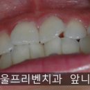 서울프리벤치과의원 이미지