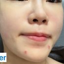 라온제나 피부바디샵