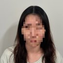 여성탈모, 두피문신 후기 (더 리움 청담점)