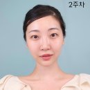 뷰티 FULL 센텔리안24 마데카프라임 피부관리기 추천. 반사판 탄력 앰플, 마데카크림과 써본 후기