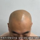 심다뷰티 - 동대문구 전농로 101 | 전주두피페인팅 효과 부작용 없이 업체 선정하는 3가지