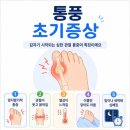 손가락 변형과 통증을 유발하는 질환 이미지