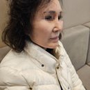 신사동 피부과 팔자주름없애기 얼굴 턱선 실리프팅 실루엣소프트 딤플 통증 효과 붓기 유지기간 추천 후기
