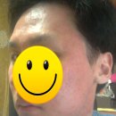 압구정역 프락셀 후기 보셀르의원