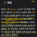 전기, 화학 작용, 방사선 화상 공격이 7/29 ~ 8/4 현재까지 진행중.계속 피부가 따갑고 따끔거리고 가렵고 열감이 있고 두드러기. 이미지