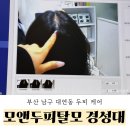 경성대 부경대역(07007) | [부산 남구 대연동] 부산 경성대•부경대역 바로 앞 두피 관리 솔직 후기 - 모앤두피탈모 부산경성대점