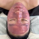 강동구 에스테틱 퓨어하늬스킨앤바디 원장님 데콜테 테크닉 짱짱 대만족후기!