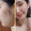 홈케어컨설팅 이미지
