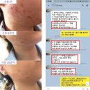 벨라센토 | 병원화장품, 무조건 믿고 사지 말아야 한다?