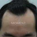 모먼트의원 이미지
