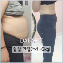 후테라피 네이버블로그