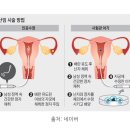 진주미래여성병원 | 난임일기 다낭성난소증후근 인공수정 1차 진주 미래여성병원 후기