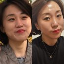 진화인셀덤 | 왜 지금 'ICD 인셀덤'인가? SGM 글로벌 사업을 놓치면 안 되는 3가지 이유