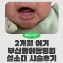 부산맘아동병원 | 2개월 아기 좋은문화병원/부산맘 아동병원 설소대 시술 후기