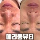 포항시북구52 | 포항 북구 에스테틱 메리움뷰티 울디엠 머미테라피 여기 찐이네