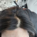 문신양계장 | 에이치앤에이치더바디(H&amp;H 더바디)에서 두피문신 SMP로 가르마 라인이 예뻐졌어요