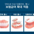 틀치과기공소 이미지