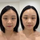 에스뷰티라인 관저동본점 | 대전 관저동 붓기와 비대칭이 고민이라면? ' 끌리메...비대칭 교정 솔직후기 / 신부관리 웨딩관리 추천