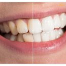 원 치과기공소 이미지