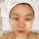 [정발산 피부관리] 아미고에스테틱에서 에스테인아크네이징받은 후기
