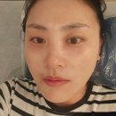 은평구피부관리&lt;이지뷰티랩&gt; 콜드플라즈마 피부관리후기