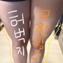 멍케어존 | 허벅지 무한람스 1주일 후기 - 붓기·멍·사이즈 변화 솔직 정리