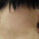 가온누리한의원 | [공지][해운대 아토피 치료후기] 해운대 가온누리한의원의 아토피 치료후기