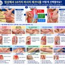 물리치료사와 수기치료사가 알아야 할 마사지 테크닉 10가지 경찰법부터 근막이완·트리거포인트 치료까지 이미지