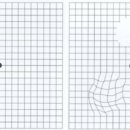 킴스안과의원 이미지