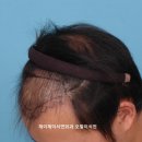 제이제이서연외과의원 네이버블로그