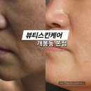 개봉1동 주민센터 | 개봉동 피부관리 50대 리프팅관리 잘하는 뷰티스킨케어