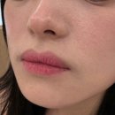 비타민 | 김해 피부관리 아우라에스테틱 김해삼계점 비타민 관리 후기