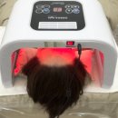 채워짐 | 이온자임 시술 후기 피부 속까지 꽉 채워짐 그리고 관리법