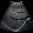 (주)유티비 이미지