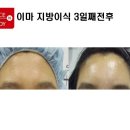 파인에프엔비 이미지