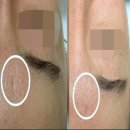 어느 오후 | 연신내역 피부관리 화이트닝 크림 사지 마세요 채우리 관리후기