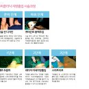 종아리지방때문에 고민이셧다면!! 제이에스미클리닉에서 종아리지방흡입하세요~