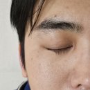 좁쌀여드름/얼굴뒤집어짐/오돌토돌 로션 추천 지루샵 세라케어 울트라로션