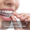 아름다운 치과기공소 | [창원교정치과] 투명교정가격과 진짜 투명교정후기 구별법!