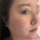 예담 | 창원얼굴경락 예담 에스테틱 솔직후기