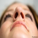 홍조