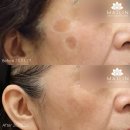 경산흑자제거비용 날리기 싫다면 꼭 확인해보세 이미지