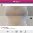 복부&발관리 | 송도 엔더몰로지 스파아루카 송도 복부관리 방문 후기 (전, 후 사진 있음!)
