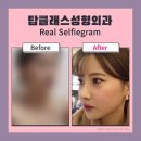 탑클래스성형외과의원 네이버블로그