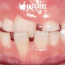 내이처럼치과병원 이미지