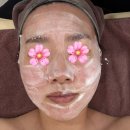 이천에스테틱 뷰티더연 수분진정 케어 후기