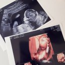 온산후조리원 이미지