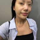 명성메디칼 | 인천서구 청라피부관리샵 솔에스테틱 건조한피부 맞춤 수분관리 후기