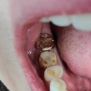 목동크라운치과의원 이미지